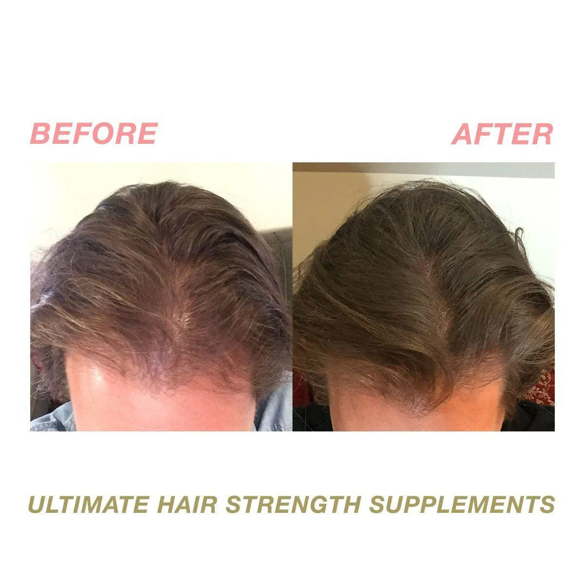 Ultimate Hair Strength PRO Supplements
