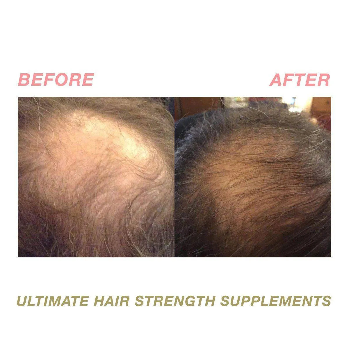 Ultimate Hair Strength PRO Supplements