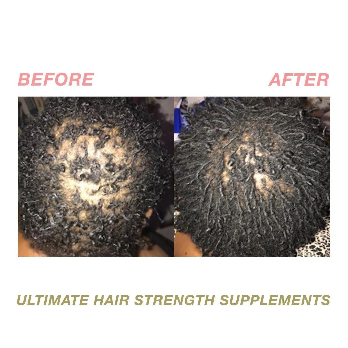 Ultimate Hair Strength PRO Supplements